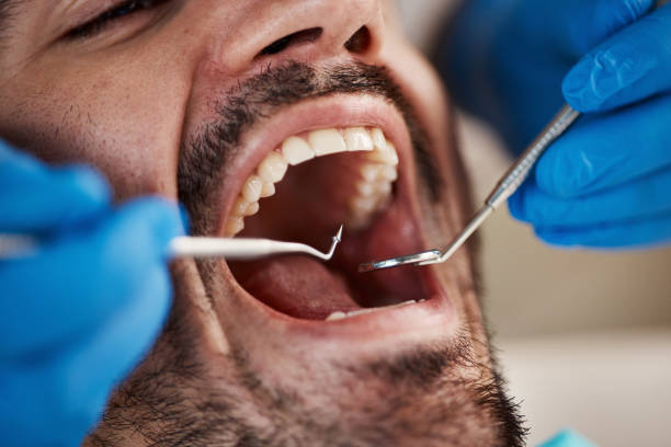 Best Pediatric Emergency Dentist in Watergate, FL