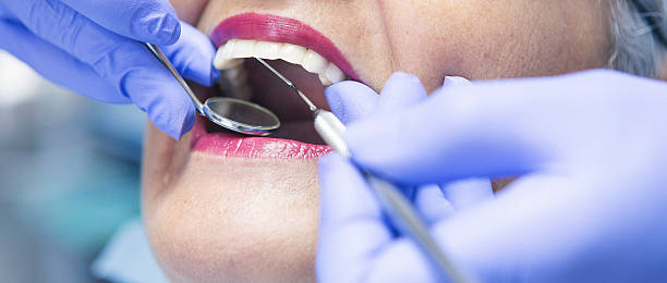 Best Emergency Tooth Extraction in Watergate, FL